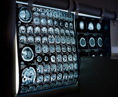 UC San Diego Health, GE HealthCare Work Together on Advanced Imaging Technology