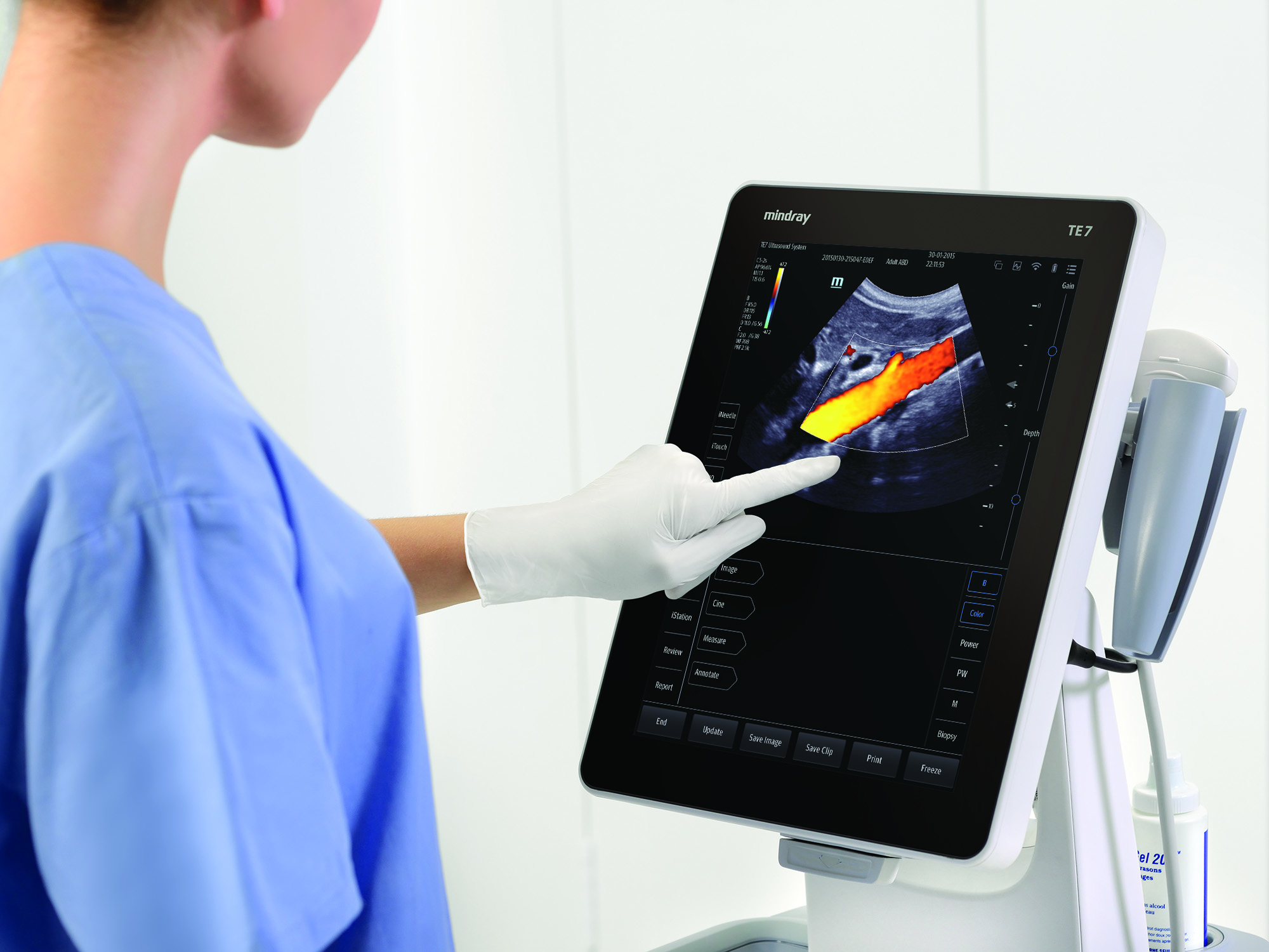 Mindray Introduces TE7 Touch Enabled Ultrasound System for Point-of-Care | Imaging  Technology News