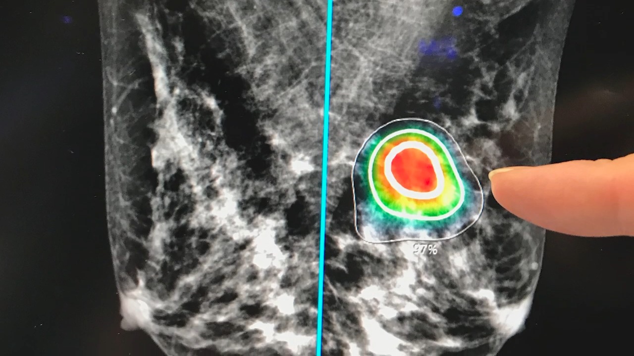 Total Medical Imaging – Healths Digest