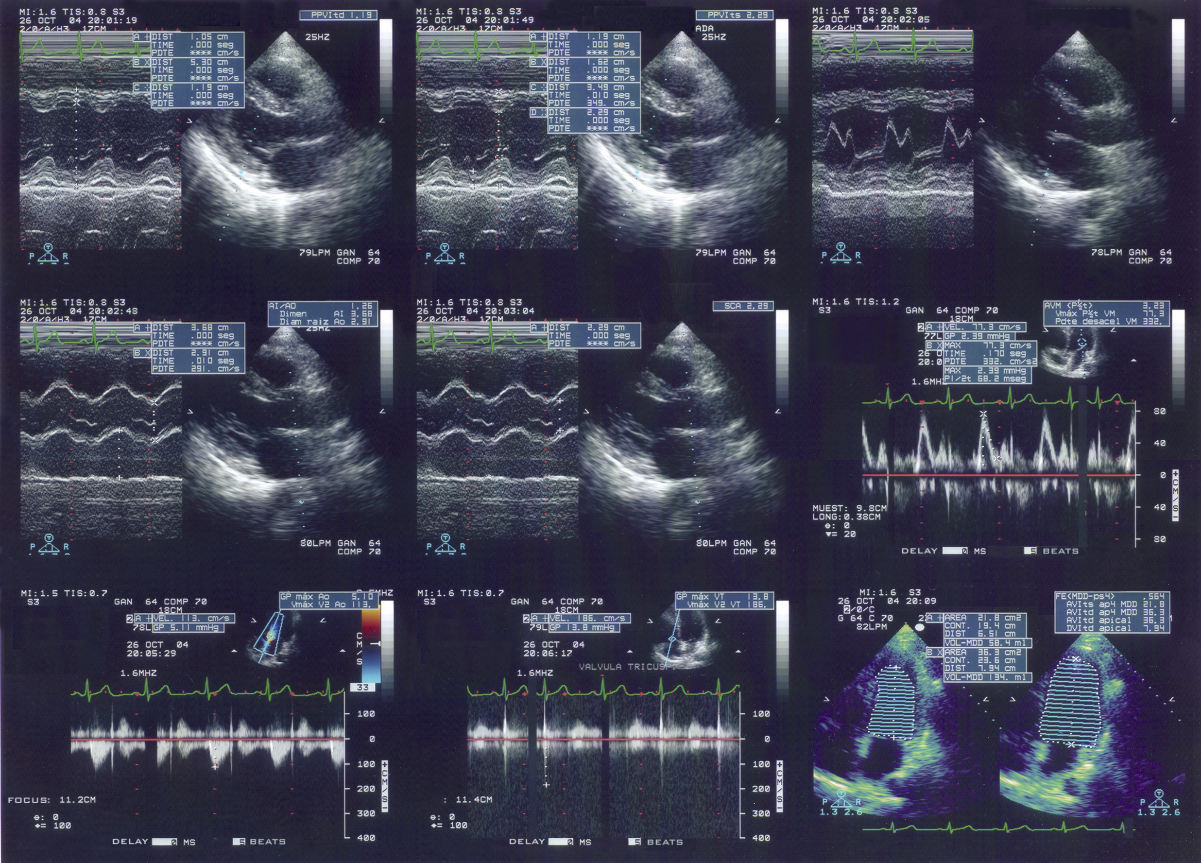 Ultrasound Systems 