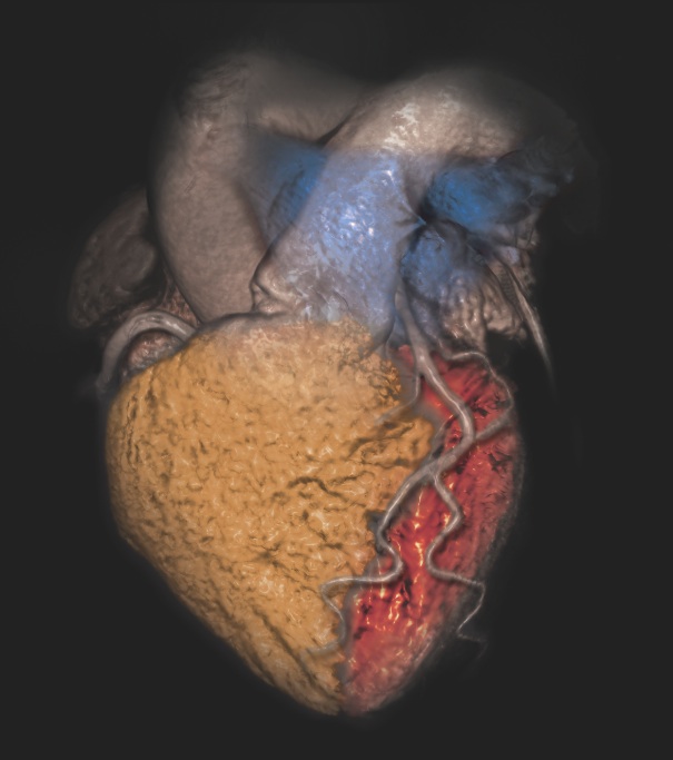 CT Systems Cardiac Ultrasound MRI Nuclear Imaging 