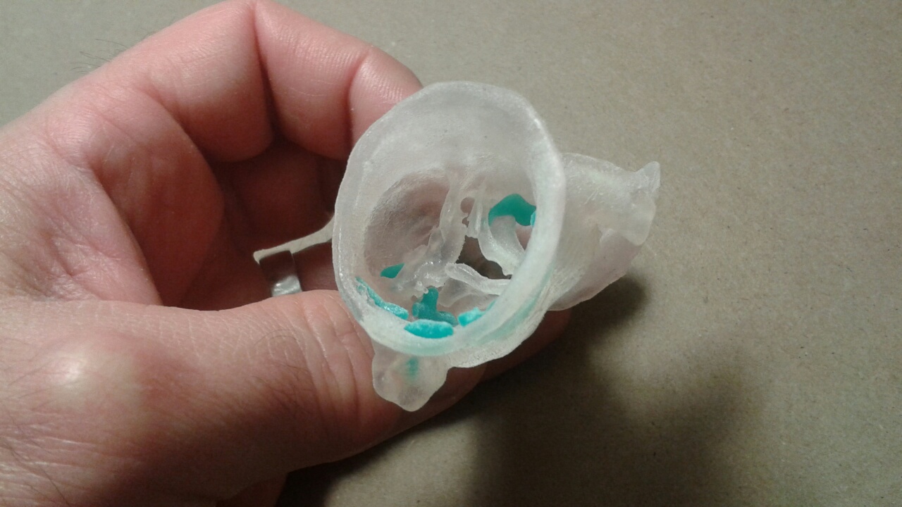 The Future Of 3 D Printing In Medicine Imaging Technology News