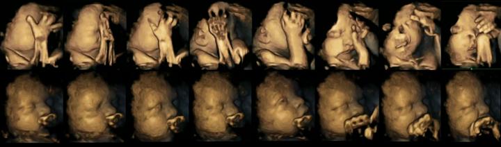 4-D scans, fetuses, smoking, effects, unborn babies, Durham, Lancaster
