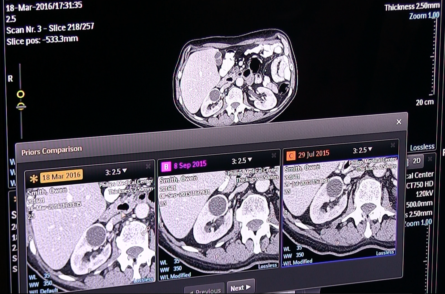 AI, deep learning, artificial intelligence, medical imaging, radiology