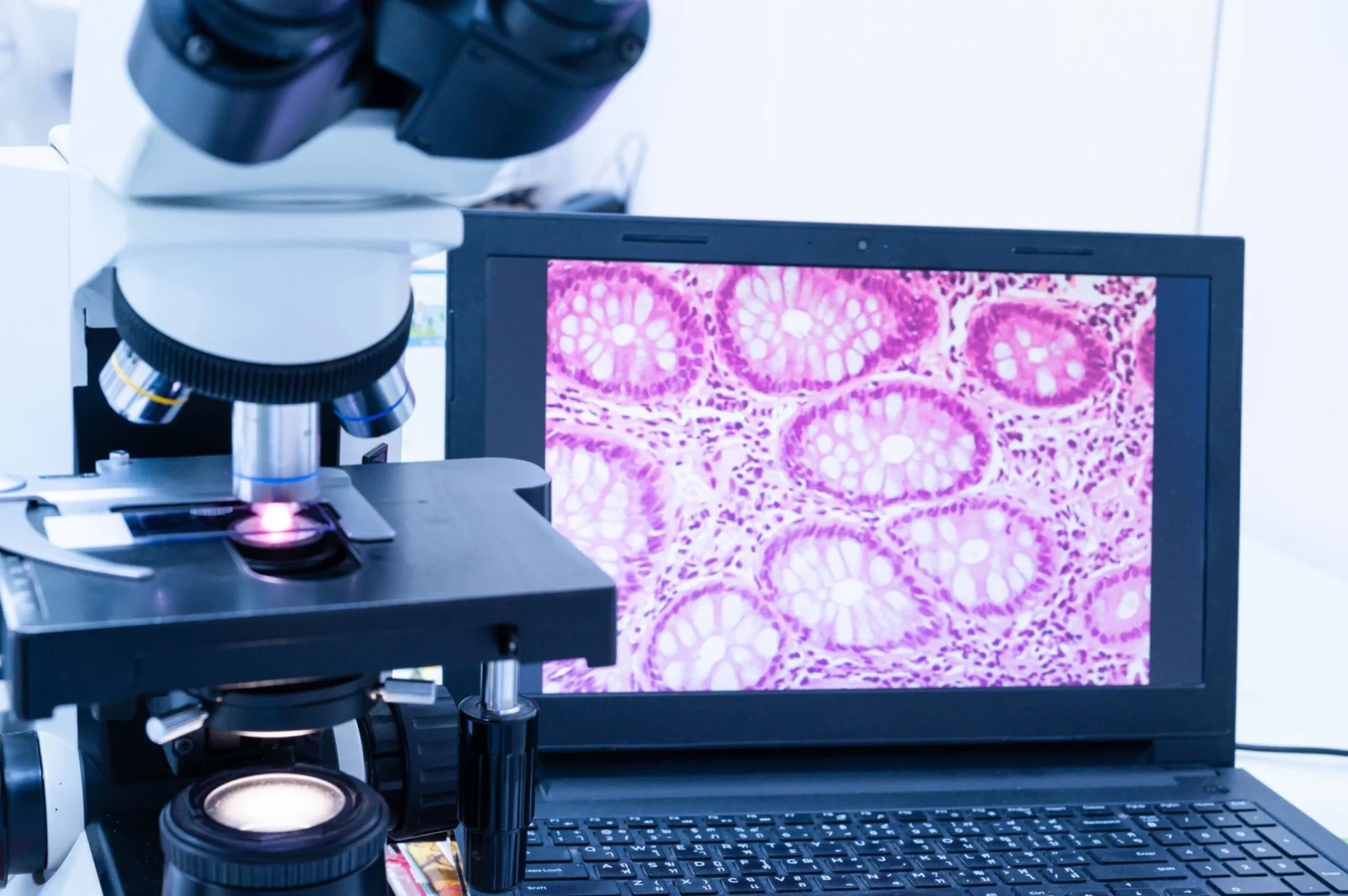 Artera MMAI Multimodal AI Shows No Evidence of Bias in Prostate Cancer Study