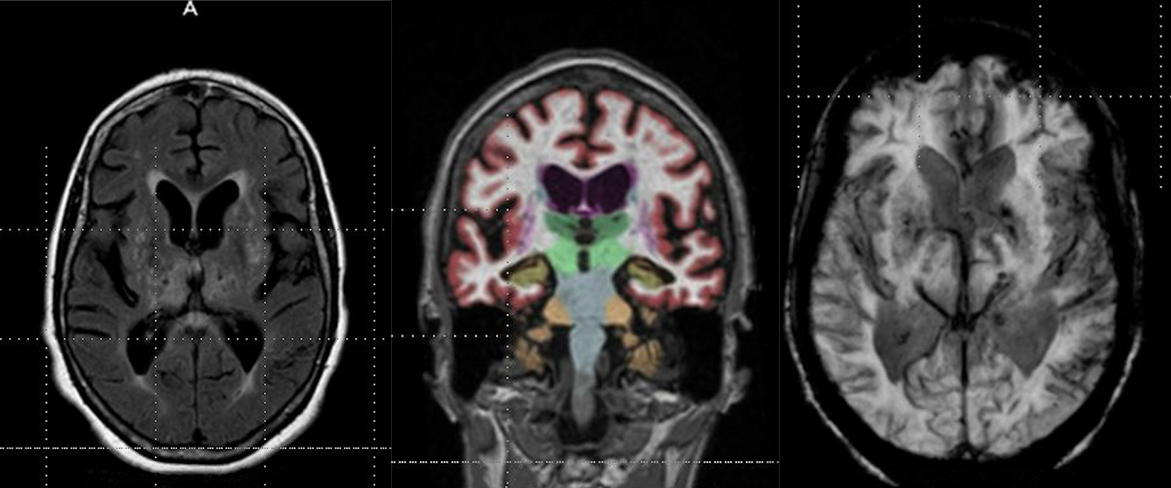 It is critical to order the right kind of test or scan, and then get those images into a place in the system where they can be useful to the physician.