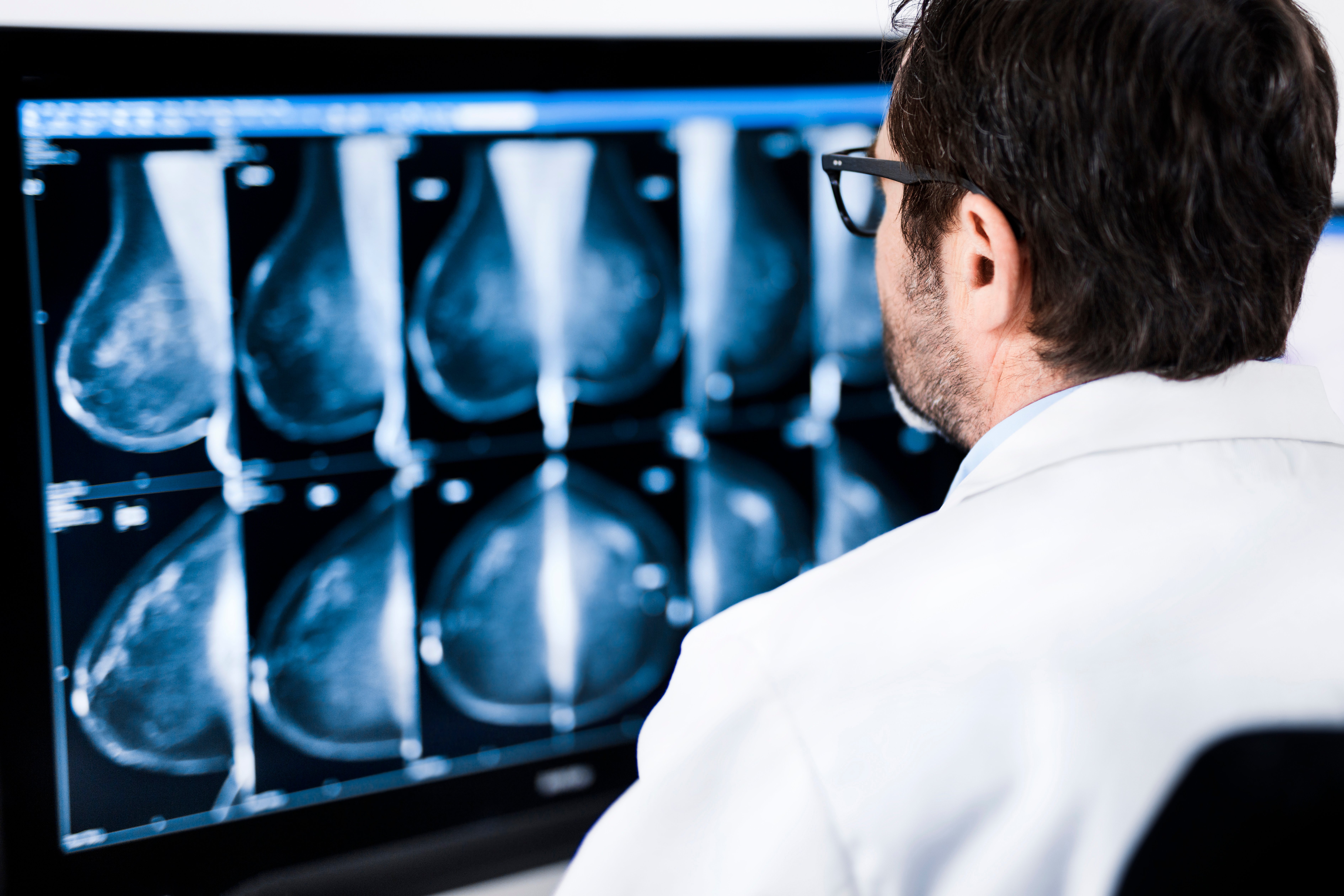 Breast imaging technologies have seen a rapid evolution.