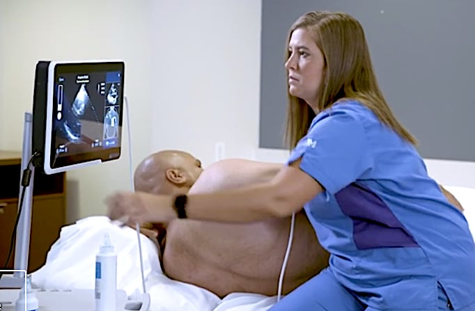 The artificial intelligence-driven Caption Guidance software guides point of care ultrasound (POCUS) users to get optimal cardiac ultrasound images. The AI software is an example of a FDA-cleared software that is helping improve imaging, even when used by less experienced users.