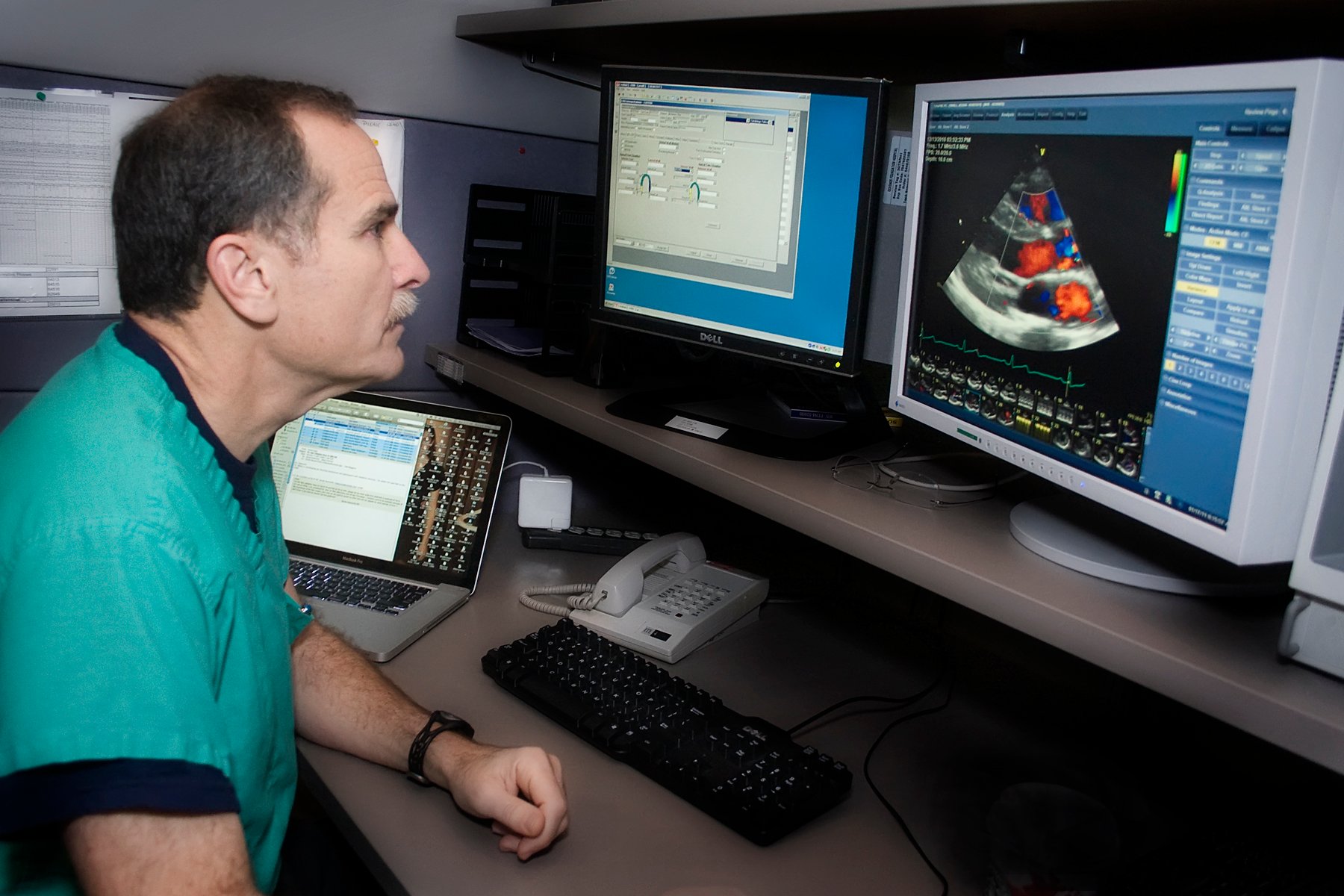 Cardiac Ultra Sound Echo ASE Choosing Wisely 5 THings Patients Should Question