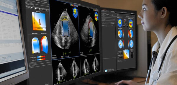 DOPPLER-CIP trial, ESC 2015, heart failure, predictor, small left ventricle, University of Leuven