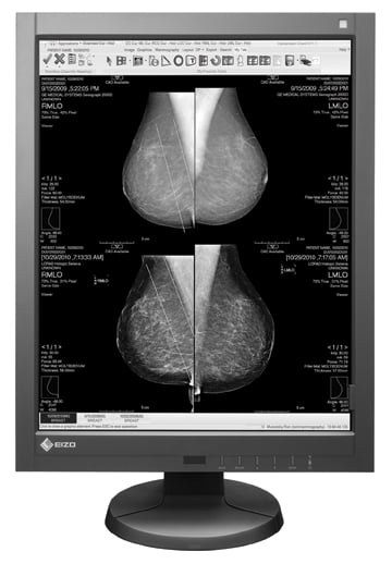 How to Choose a Diagnostic Flat Panel Display