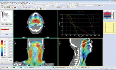 Differences between VMAT and tomotherapy help increase efficiency in radiation oncology