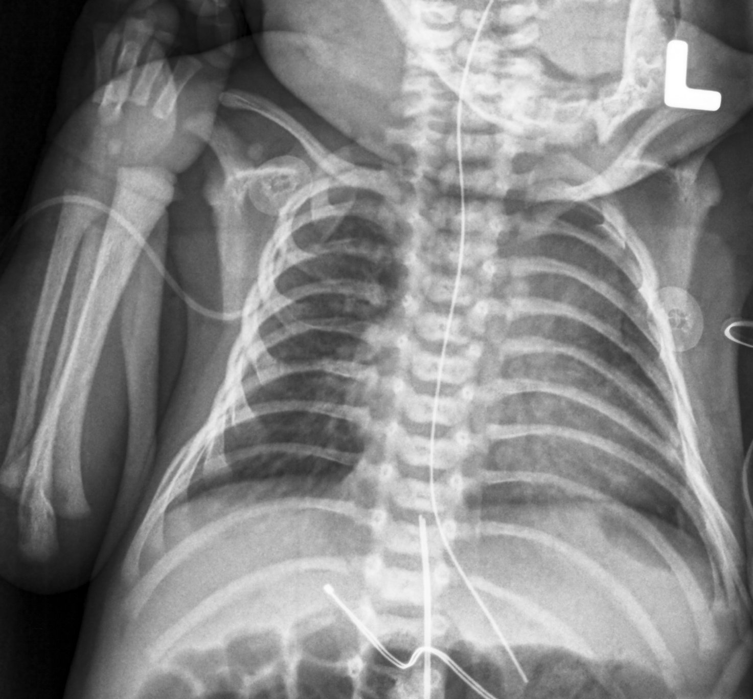 FDA Releases New Guidance on Children's X-ray Exams