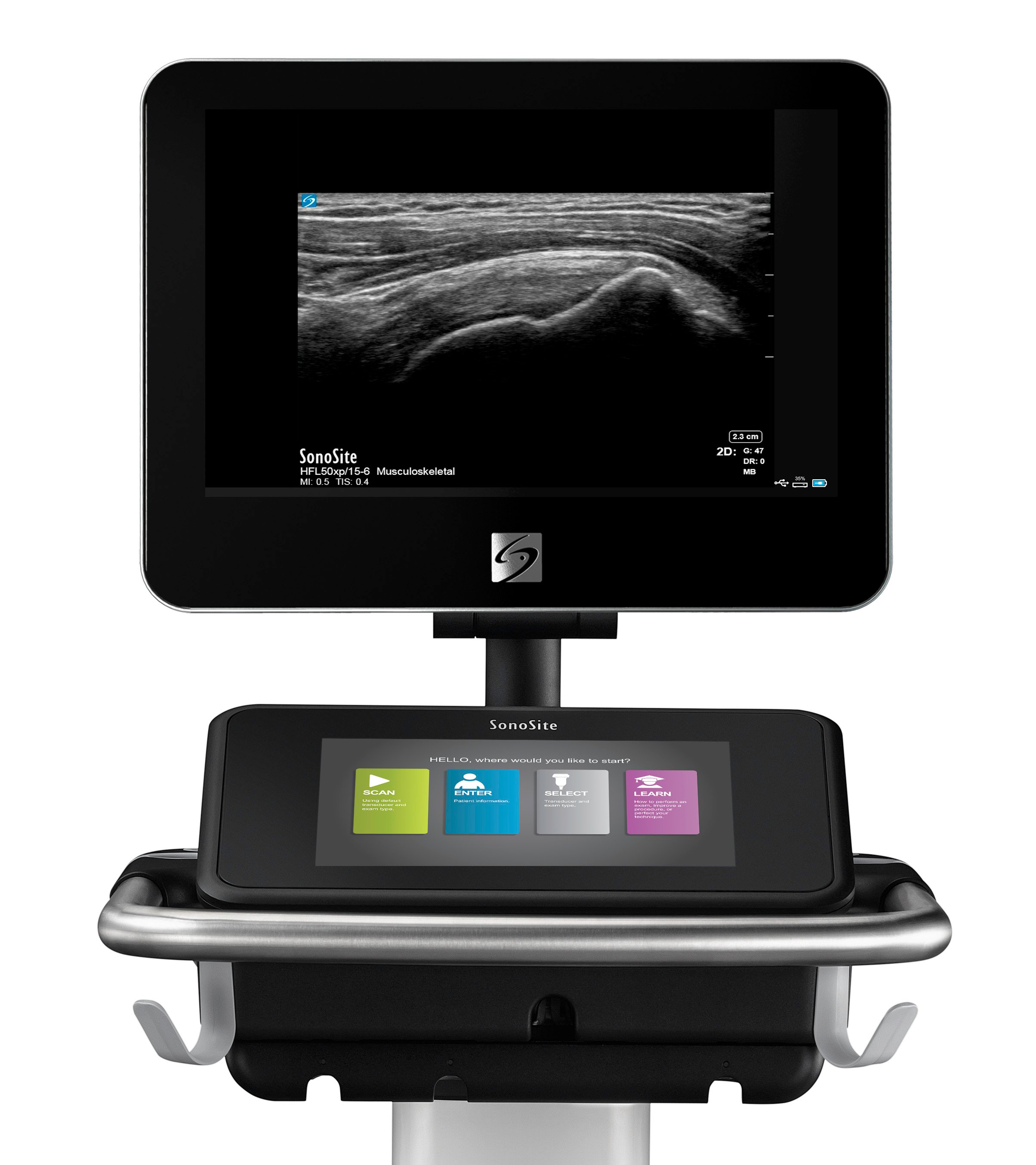 Fujifilm offers several point-of-care ultrasound systems, from cart-based to handheld. This is the SonoSite X system.