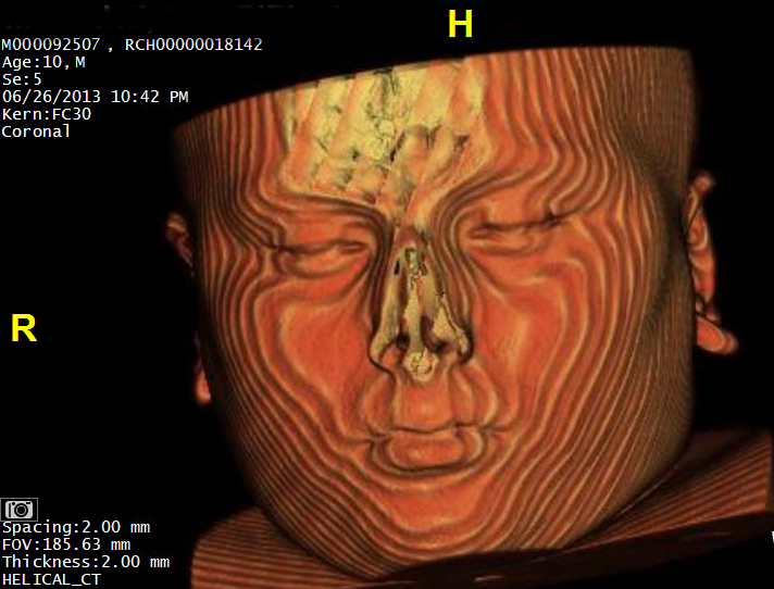 CT systems, Clinical trial/study, ARRS