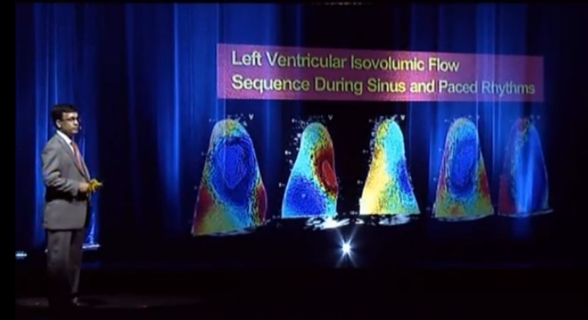 Hologram on stage at ASE 2013