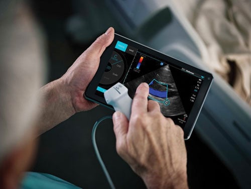 Fujifilm Sonosite took a different route for handheld ultrasound systems with its iViz, used for point of care ultrasound.