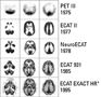 973: Michael E. Phelps invented the first positron emission tomography (PET) system.