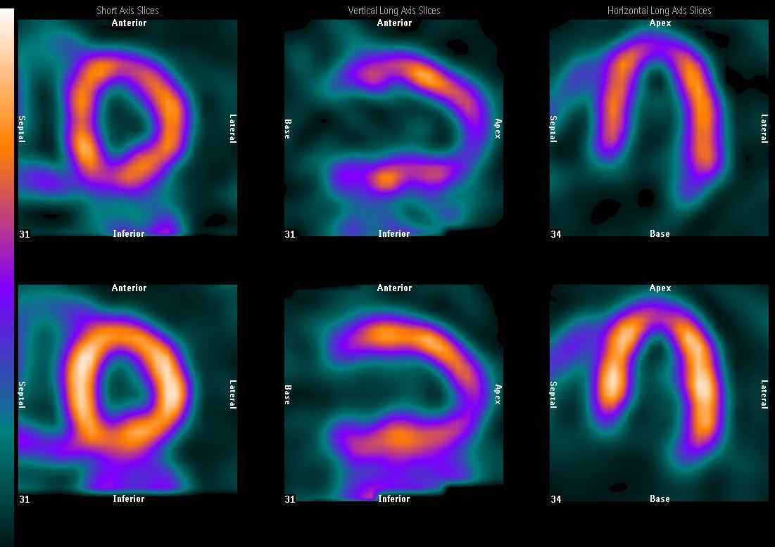 Hybrid Imaging: The Best of Both Worlds