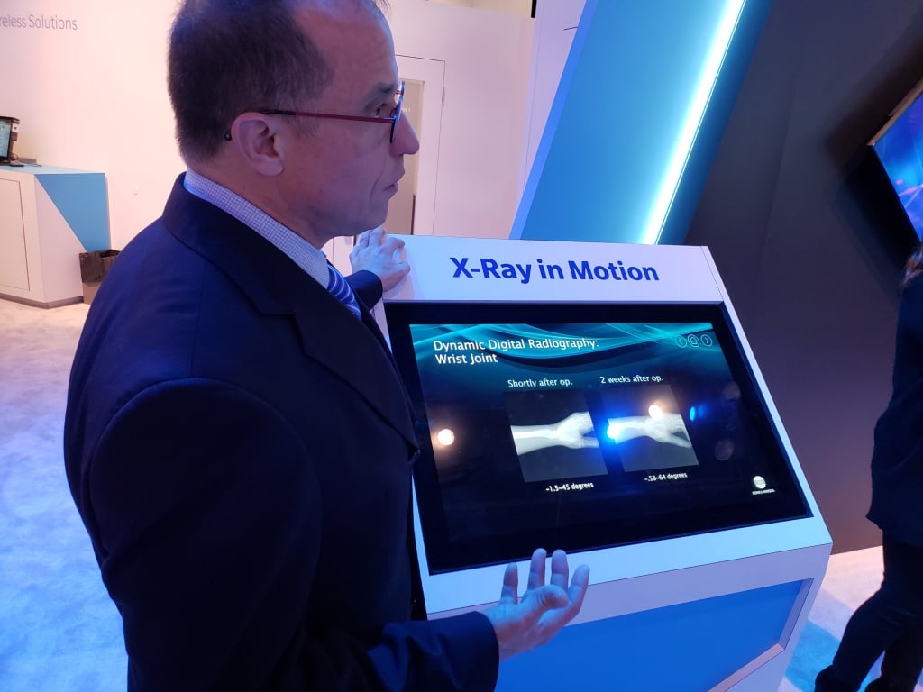 Konica Minolta showcased at RSNA 2018 a work-in-progress that gives new meaning to the word “dynamic.”