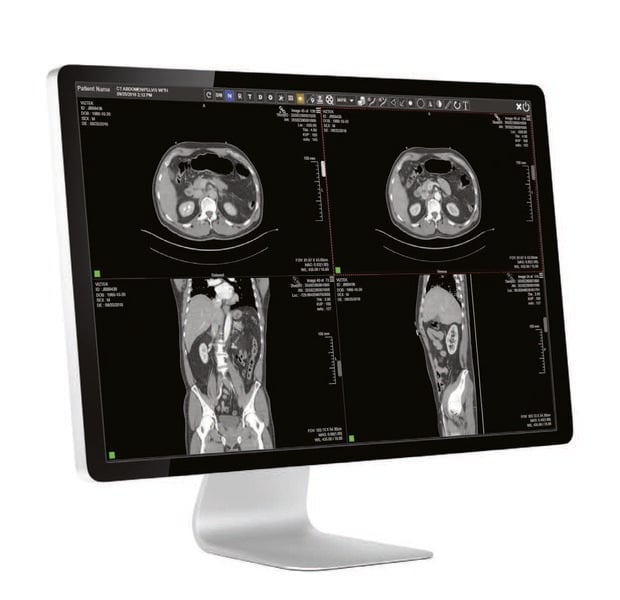 Konica Minolta's Exa Platform