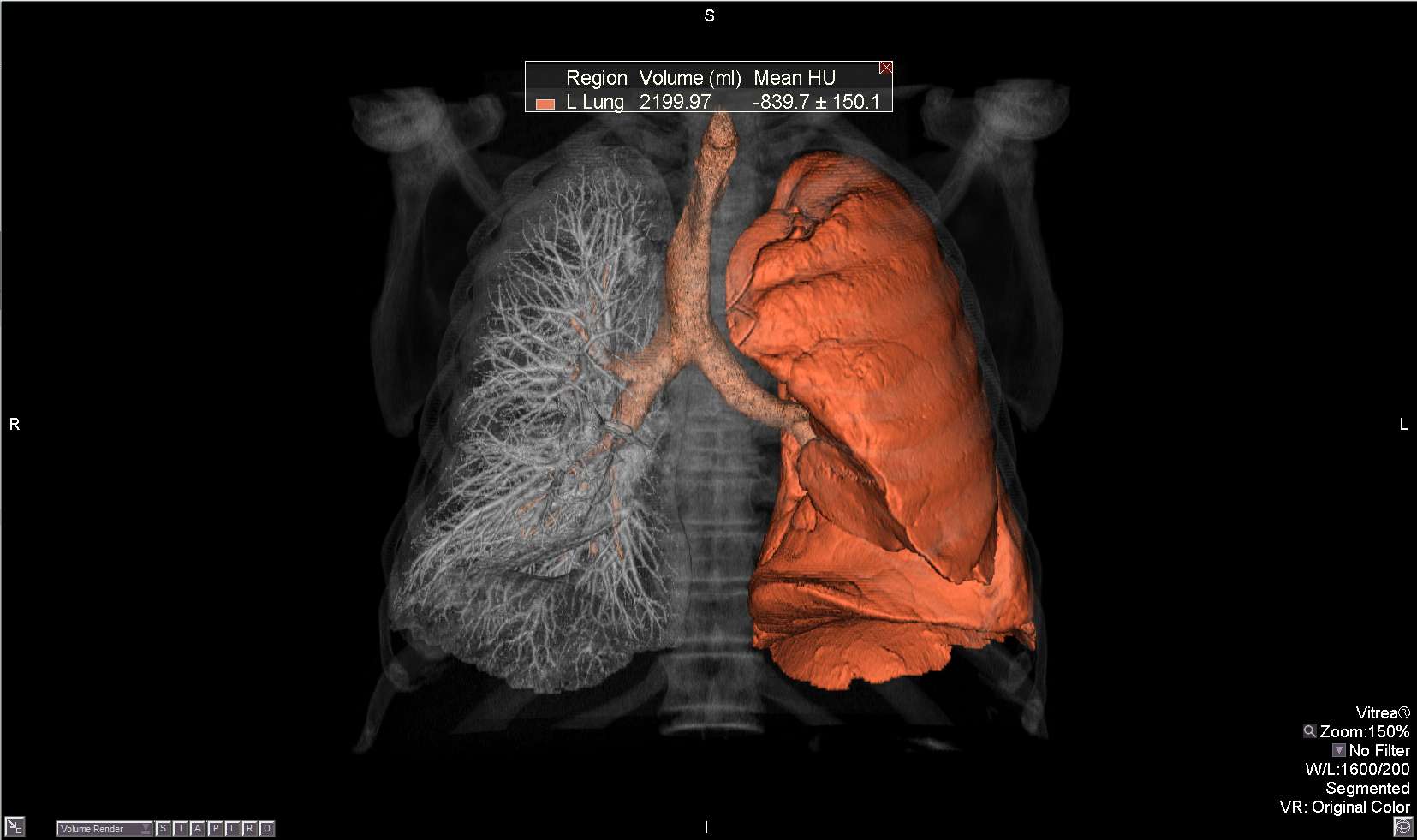 ASTRO Medicare Low-Dose CT Screening Adults Lung Cancer CT Systems