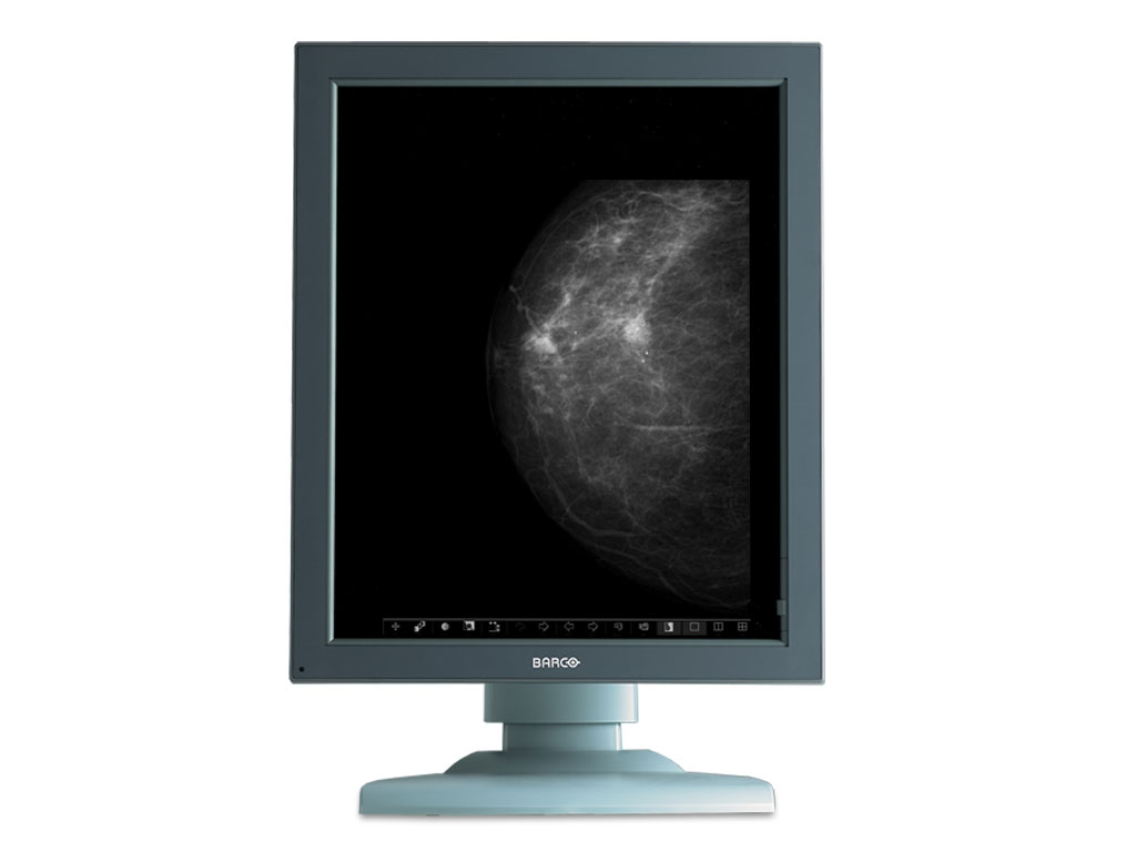 Mammography Women's Health ACR SBI NEJM Article