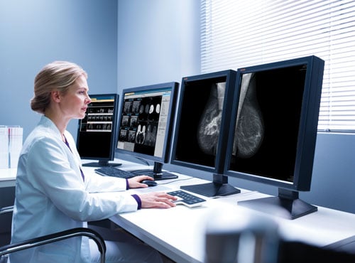 conflicting information surrounding screening mammography, breast screening guidelines, debate over mammography guidelines, 