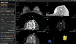  Morphology_analysis