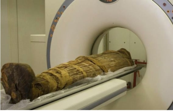 The top article from January was about researchers in Sweden using computed tomography (CT) to image the soft tissue of an ancient Egyptian mummy’s hand down to a microscopic level. Non-destructive imaging of human and animal mummies with X-rays and CT has been a boon to the fields of archaeology and paleopathology. Most popular radiology articles and news in January 2019. 