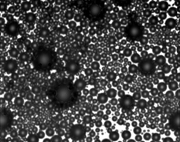The microbubbles that make up the ultrasound contrast agent Optison.