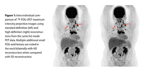 PET imaging