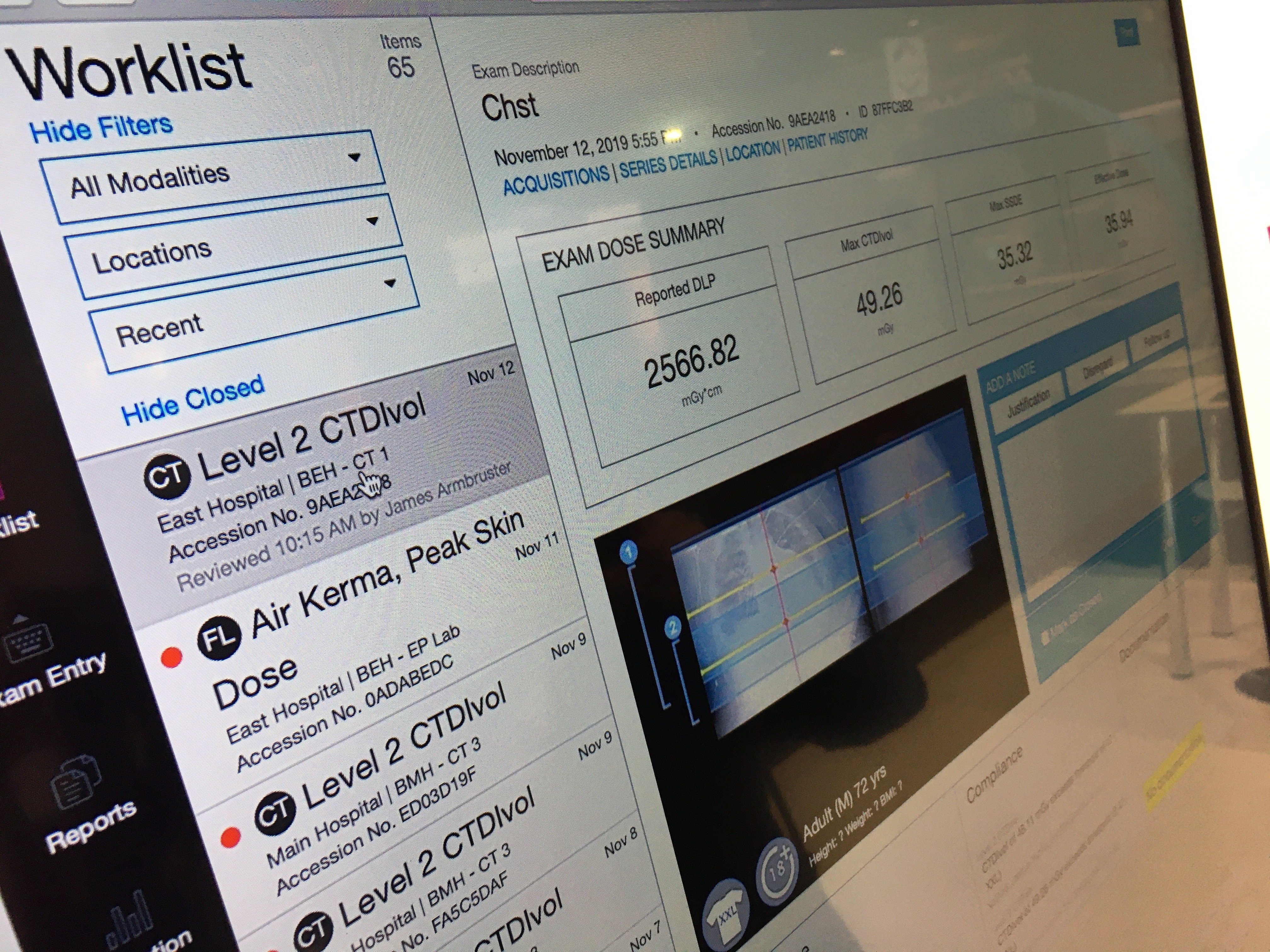 CT imaging radiation dose tracking software from Imalogix displayed at RSNA 2019.