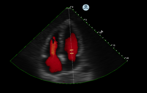 Simbionix, 3D Systems, echo simulator