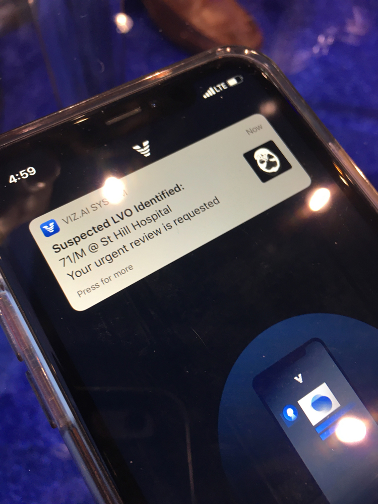 A notification on a physician's phone showing a automated potential stroke alert on their iPhone from the FDA-cleared Viz.AI app.