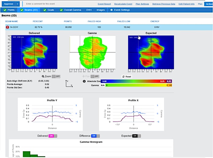 Sun Nuclear’s SunCHECK Patient QA uses calibrated EPID data to enable true dosimetric in-vivo monitoring, creating a fully independent absolute dosimetric QA of patient treatments.