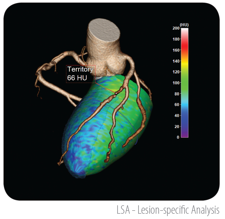 TeraRecon Lesion-Specific Analysis