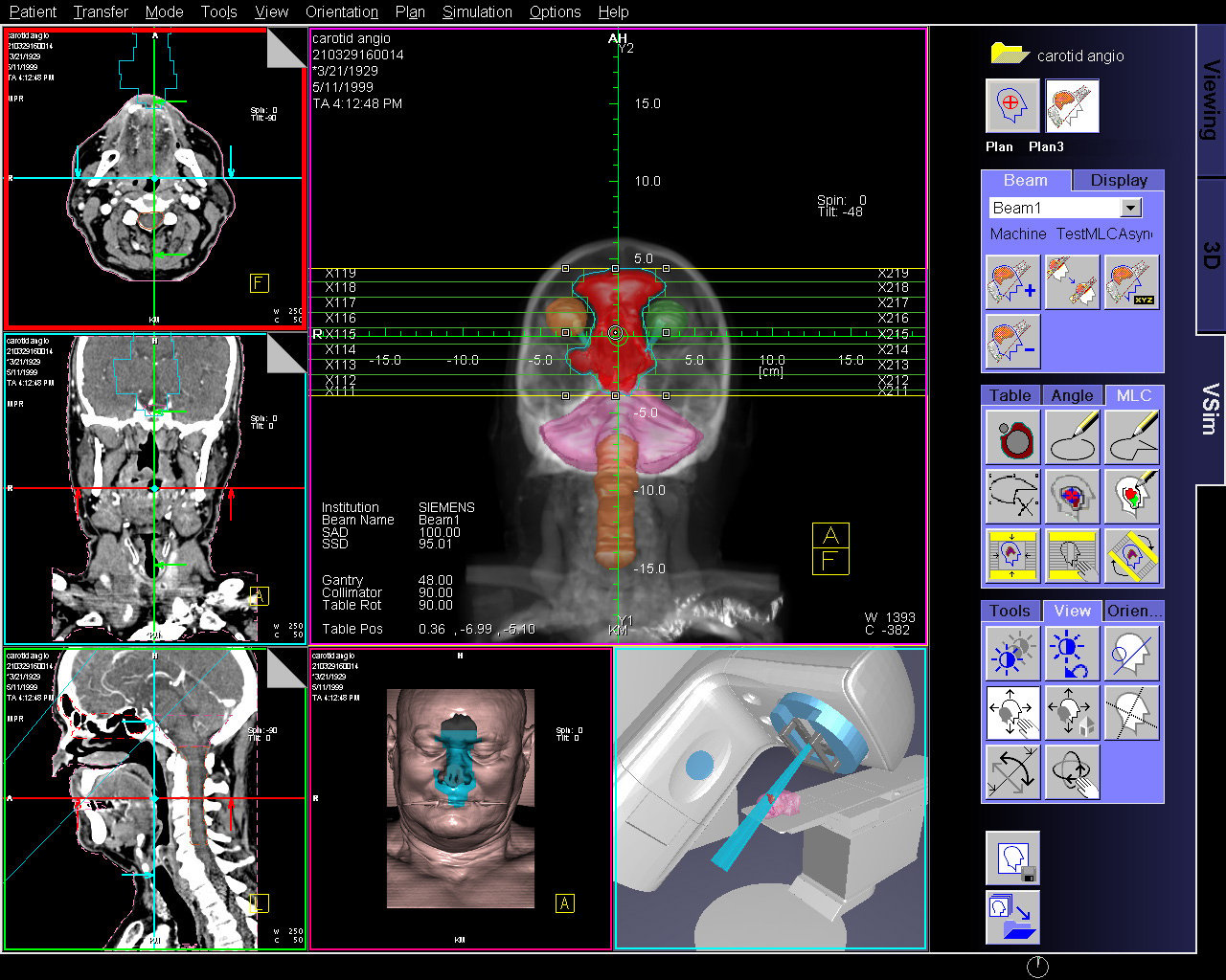 Treatment Planning systems, RT planning software