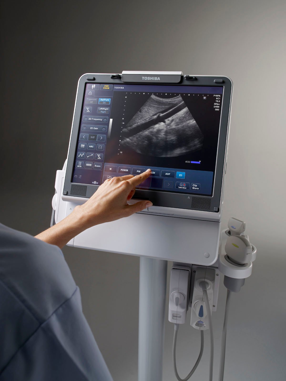 2013 Ultrasound Market Report Klein Biomedical Consultants Inc.