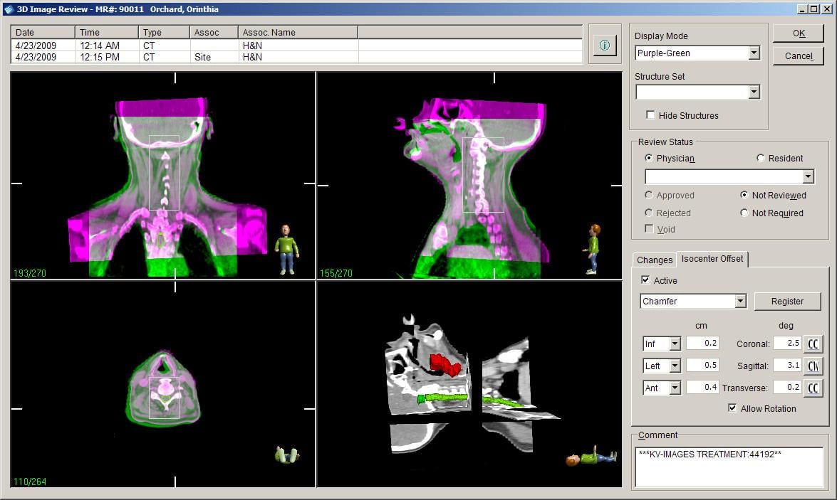 treatment planning system, elekta, aapm