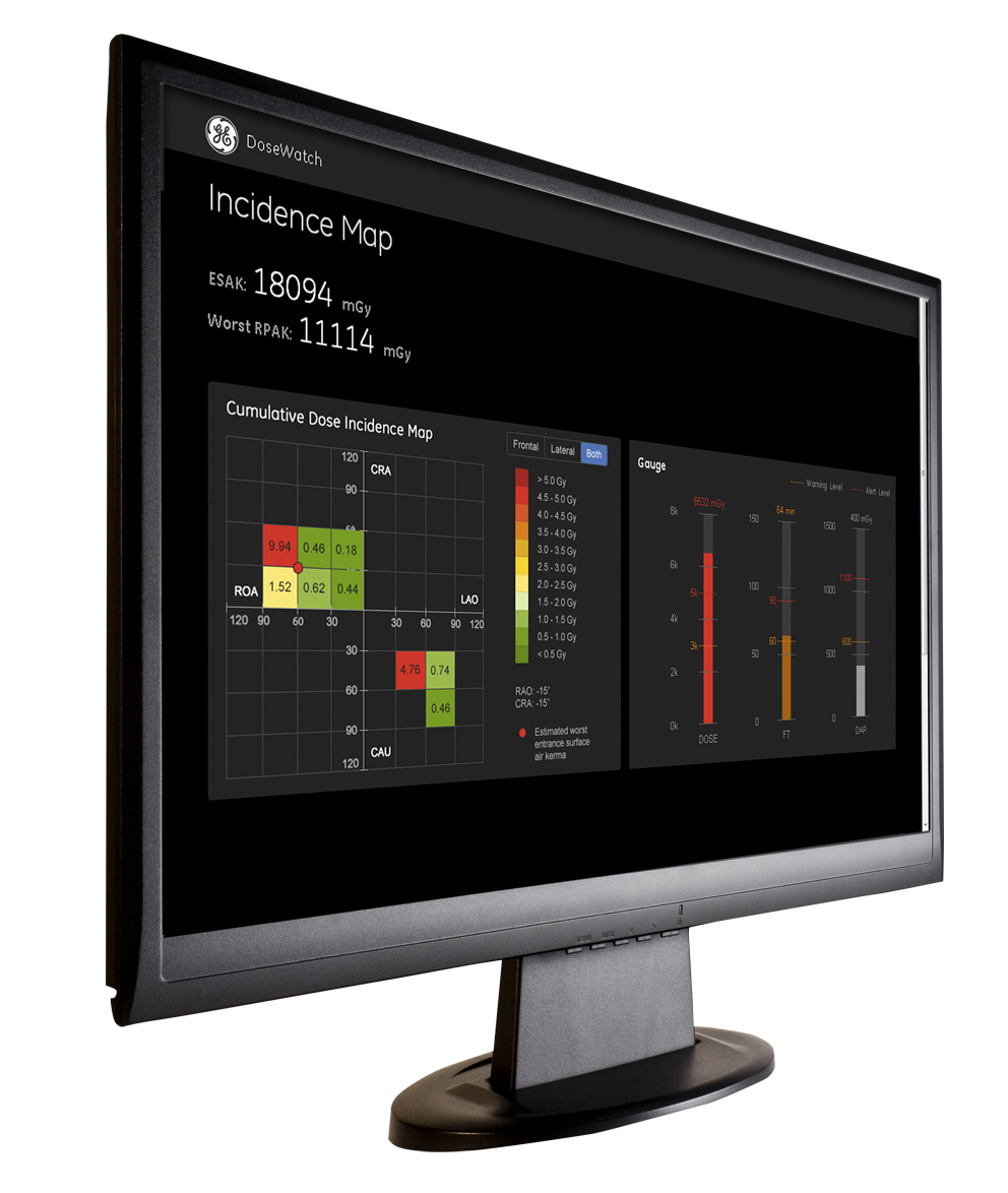 radiation dose management, monitoring