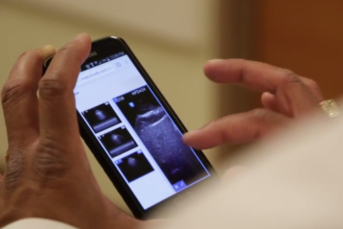 Samsung Tablet-based Ultrasound Trial Shows Lifesaving Potential in Emergency Services