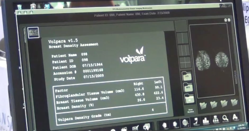 Volpara, VolparaAnalytics, VolparaDensity, mammography, pressure, study