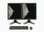 CAD Gives a Boost to Breast Imaging