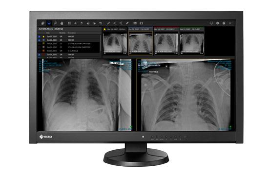 In April, the U.S. Food and Drug Administration (FDA) cleared Intelerad’s InteleConnect EV solution for diagnostic image review on a range of mobile devices. 