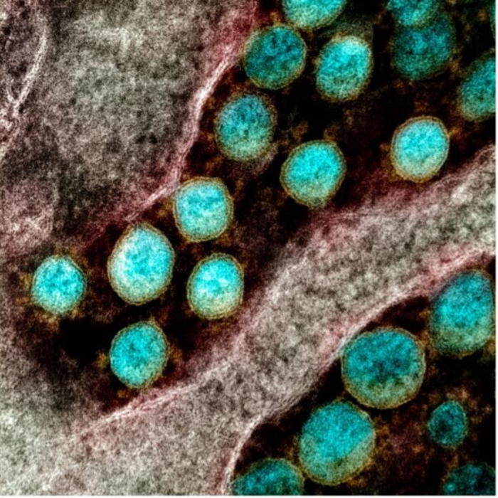 Transmission electron micrograph of SARS-CoV-2 virus particles, isolated from a patient. Image captured and color-enhanced at the NIAID Integrated Research Facility (IRF) in Fort Detrick, Maryland. Image courtesy of NIAID
