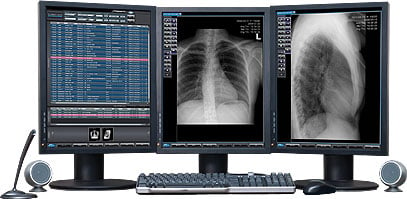 How to pick a teleradiology company.