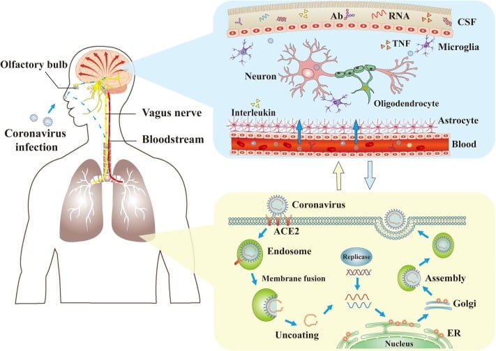 Fig. 1. The mechanisms of coronaviruses infections and neurological damage caused by coronaviruses. The coronaviruses can cause nerve damage through direct infection pathways (blood circulation pathways and neuronal pathways), hypoxia, immune injury, ACE2, and other mechanisms. Meanwhile, the coronaviruses have detrimental effects to attack the lung tissue, and causes a series of lung lesions such as hypoxia. Furthermore, the coronaviruses can enter the nervous system directly through the olfactory nerve, and also enter the nervous system through blood circulation and neuronal pathways, resulting in neurological disorders. Ab: antibody; ACE2: angiotensin-converting enzyme 2; CSF: cerebrospinal fluid; ER: endoplasmic reticulum; TNF: tumor necrosis factor.  https://www.sciencedirect.com/science/article/pii/S0889159120303573 #COVID19