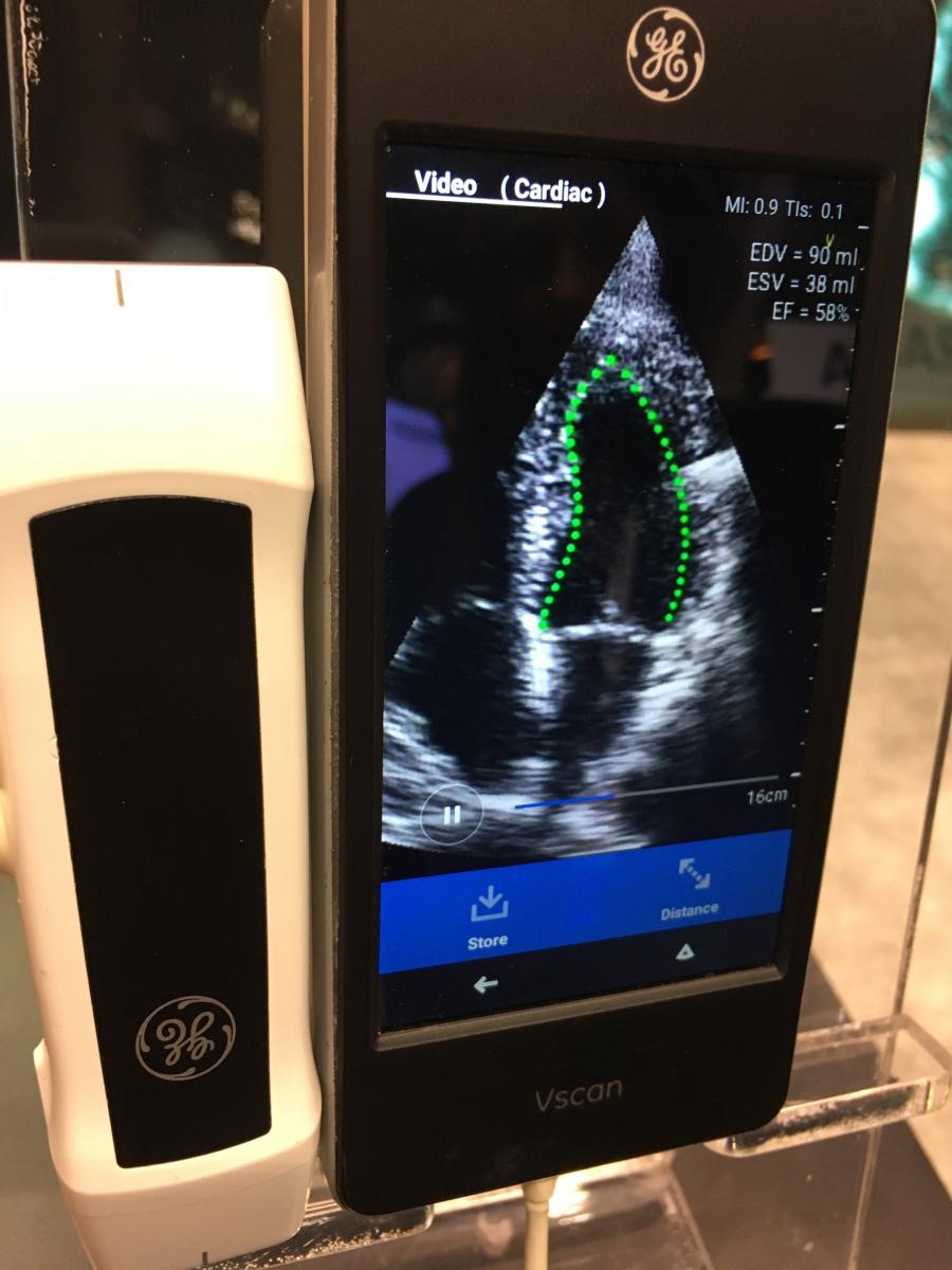 Example of Dia's AI-enabled automatic ejection fraction calculation on a GE vScan system at RSNA 2019.
