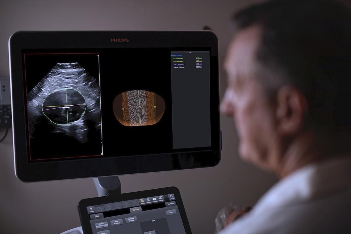 Philips' Abdominal Aortic Aneurysm (AAA) Model, providing physicians a more patient-friendly solution compared to the current standard of care for managing AAA patients.